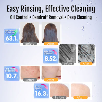 Máquina de spa profesional de micro nanoburbujas generadora de nanoburbujas de hidrógeno para rejuvenecimiento de la piel, hidratación y tratamientos de belleza antienvejecimiento